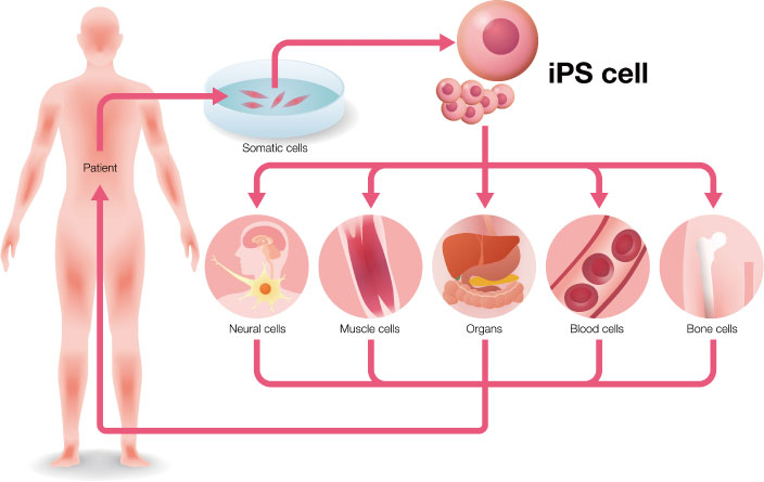 iPS cell